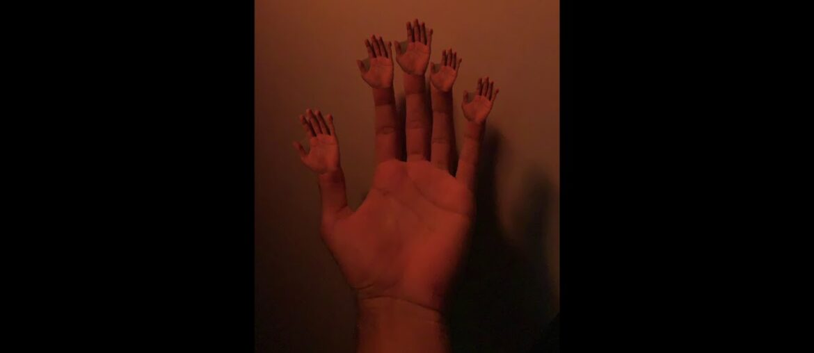 This is What Depression Sounds Like – Gale Shannon This is What Depression Sounds Like - Gale Shannon