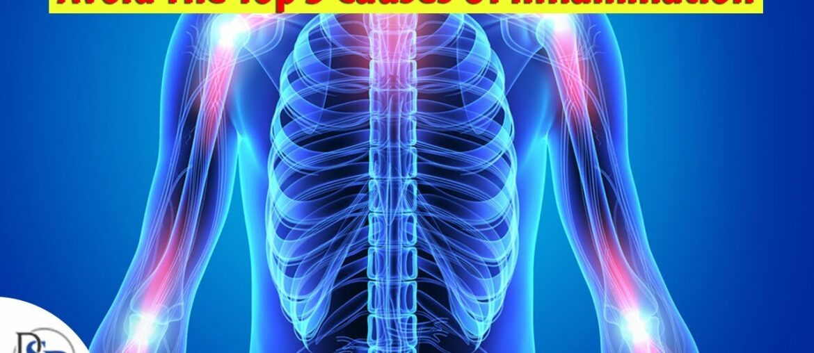 Avoid The Top 3 Causes Of Inflammation (Clinically Proven) – Part 2 Avoid The Top 3 Causes Of Inflammation (Clinically Proven) - Part 2