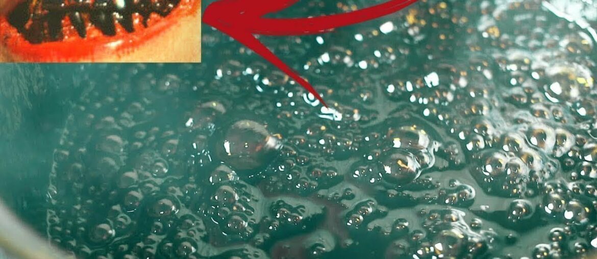 Coke Vs Teeth (Boil Coke and Sugar)=??? Coke Vs Teeth (Boil Coke and Sugar)=???