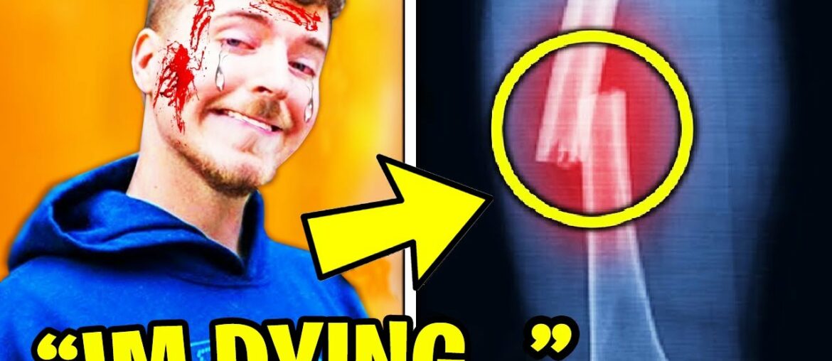 6 SECRETS You Didn't Know About MrBeast! (SHOCKING) 6 SECRETS You Didn't Know About MrBeast! (SHOCKING)