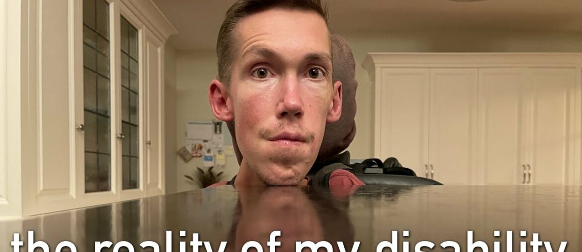 What is wrong with Shane’s voice? What is wrong with Shane’s voice?