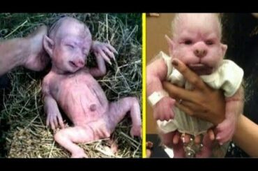 The midwife couldn't stop screaming when she realized what this woman gave birth to