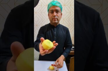 How to make Crispy Potato Fries Recipe | Finger chips | french fries #Shorts