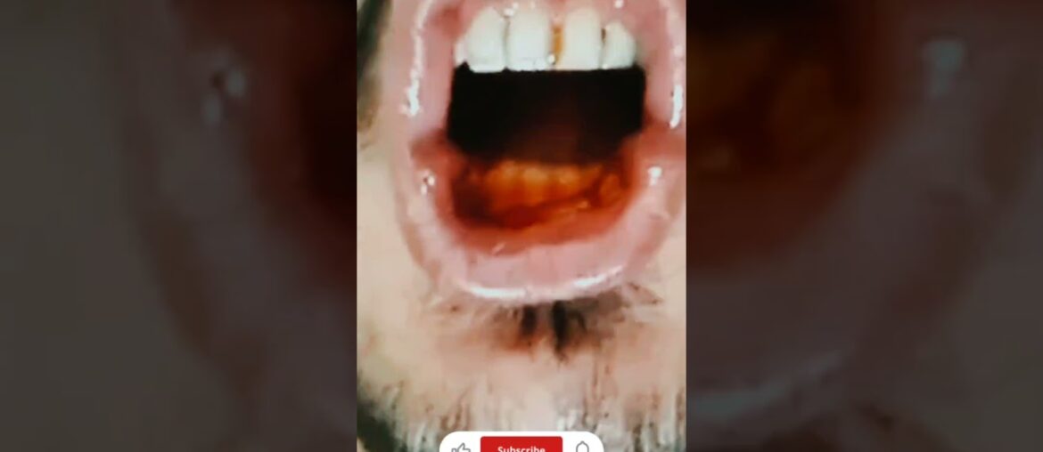 eateeth #shorts #beard #mukbang #peach #eating #video #food #drink #eatingsounds #gaming #eatingshow