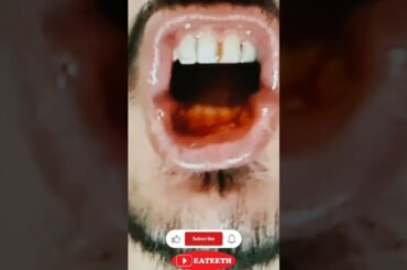 eateeth #shorts #beard #mukbang #peach #eating #video #food #drink #eatingsounds #gaming #eatingshow