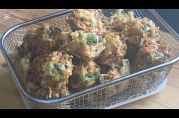 Amazing Potato Recipe || French Fries Recipe ||Potato Balls || Potato Snacks