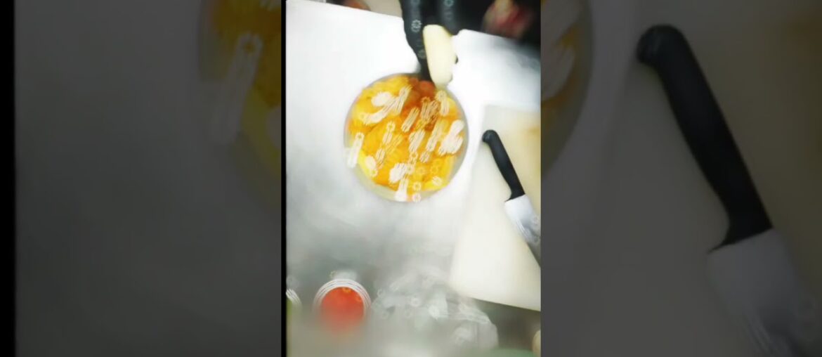 chicken noted french#trending #viralchicken french fries recipe malayalam chicken noted french#trending #viralchicken french fries recipe malayalam